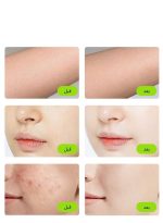 ⁦ملاي جهاز إزالة الشعر IPL T14 5 في 1، إزالة الشعر بالليزر بتبريد 3℃، 500,000 ومضة 0.5 ثانية/ومضة جهاز إزالة الشعر بدون ألم لإزالة حب الشباب/تجديد البشرة لكامل الجسم بيكيني وجه ذراع إبط ظهر ساق⁩ - الصورة ⁦2⁩