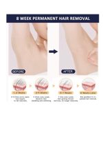 ⁦ملاي جهاز إزالة الشعر IPL T14 5 في 1، إزالة الشعر بالليزر بتبريد 3℃، 500,000 ومضة 0.5 ثانية/ومضة جهاز إزالة الشعر بدون ألم لإزالة حب الشباب/تجديد البشرة لكامل الجسم بيكيني وجه ذراع إبط ظهر ساق⁩ - الصورة ⁦10⁩