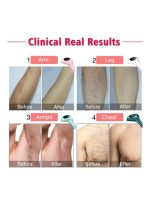 ⁦جهاز إزالة الشعر بالليزر الدائم IPL بقوة 900000 ومضة للاستخدام على الجسم والوجه، نظام إزالة الشعر بالليزر للحصول على نتائج دائمة وغير مؤلمة في المنزل⁩ - الصورة ⁦7⁩