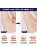 ⁦ملاي أحدث جهاز لإزالة الشعر بالليزر T14 سريع وغير مؤلم، 3 طبقات ضغط بارد/5 مستويات/500000 نبضة، أزرق داكن⁩ - الصورة ⁦5⁩