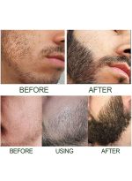 إيست مون مصل نمو اللحية هايبر ديرما رولر - للرجال زيت إكليل الجبل محسن نمو الشارب مصل العناية بتساقط الشعر مع رول اللحية 60 مل - Image 8