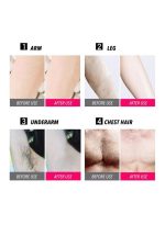 ⁦جهاز إزالة الشعر بالليزر مصغر يحمل باليد أبيض⁩ - الصورة ⁦2⁩