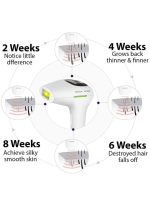 ⁦روك بو جهاز ليزر بتقنية الضوء النابض المكثف لإزالة الشعر بشكل دائم أبيض⁩ - الصورة ⁦2⁩