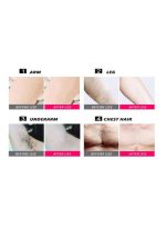 ⁦إيزي سو جهاز إزالة الشعر بالليزر مصغر يحمل باليد أبيض⁩ - الصورة ⁦3⁩