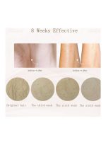 ⁦ملاي جهاز إزالة الشعر بشكل دائم باستخدام الليزر أزرق/ أبيض⁩ - الصورة ⁦5⁩