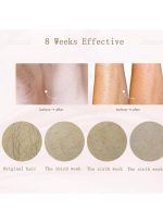 ⁦ملاي جهاز إزالة الشعر بالليزر T3 وردي⁩ - الصورة ⁦4⁩