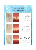 ⁦ملاي جهاز T14 بتحديث عام 2022 لإزالة الشعر بالليزر بسرعة دون ألم مع رأس بارد بحرارة 3 درجات مئوية و5 مستويات طاقة و500000 نبضة⁩ - الصورة ⁦6⁩