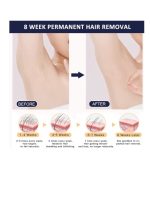 ⁦ملاي جهاز T14 لإزالة الشعر مزود بثلاث عدسات واحدة لشعر الجسم وواحدة لإزالة التجاعيد وشد البشرة وواحدة لإزالة حب الشباب باللون الأزرق الداكن⁩ - الصورة ⁦4⁩