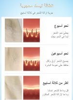 ⁦ملاي جهاز إزالة الشعر IPL T14 5 في 1، إزالة الشعر بالليزر بتبريد 3℃، 500,000 ومضة 0.5 ثانية/ومضة جهاز إزالة الشعر بدون ألم لإزالة حب الشباب/تجديد البشرة لكامل الجسم بيكيني وجه ذراع إبط ظهر ساق⁩ - الصورة ⁦6⁩